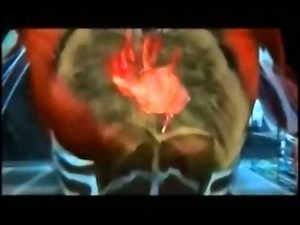 National Geographic: The Science and Truth About Anabolic Steroids