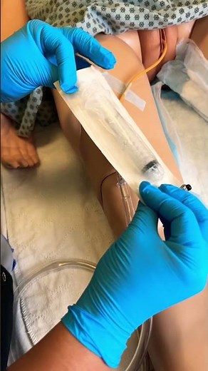 Foley Catheter Removal