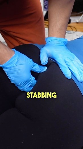 Stabbing Tail Bone Pain So Severe, No Other Treatment Could Help 😰 Nothing seemed to provide relief. She took a flight to see if she could get relief Tailbone pain that never goes away is one of the most excruciating pains you can experience long term. 😰 In this video, Dr. Donovan Smolich performs a unique external coccyx adjustment combined with low-level laser therapy. Finally, she found the relief she’s been searching for. I was happy she was able to get huge relief for the first time 🙏 pl