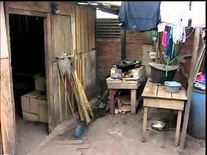 NIÑA CON PROGERIA