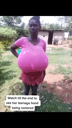 #gigantomastiafoundation#gigantomastia #tiktokke #trending #tre #viral #Fyp #tiktokkenya#fypシ#viraltiktok