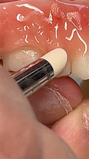 How to makes print dentures pretty!!! Pattern.com/lukekahng. YouTube.com/lsk121 | CEO Luke Kahng