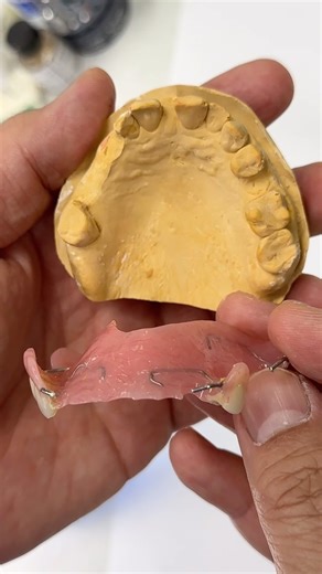 Upper Acrylic Partial! Case from Dr. Marlina Pratt in Oklahoma! | CEO Luke Kahng