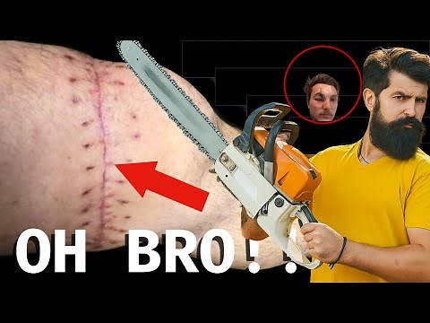 10 Shocking Chainsaw Accidents Ever Caught on Camera | OSHA Fails