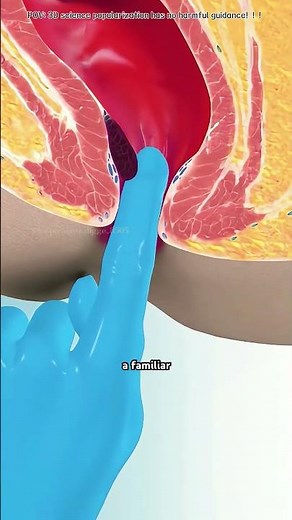 Digital Rectal Exam Procedure (3danimation) #digital #digitalart #digitalrectal #rectal #rectalexam