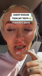 56K views · 241 reactions | Losing my teeth at 28 wrecked my confidence  | Ultimate | Facebook