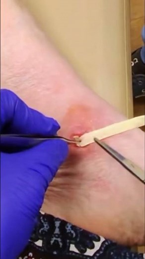 What are we packing in the ankle?! 😳