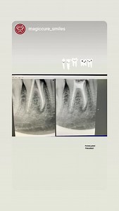 DentalKart on Reels | Facebook