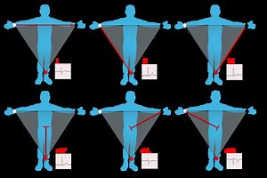 Einthoven's triangle - Alchetron, The Free Social Encyclopedia