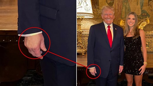 Trump’s Granddaughter Accidentally Reveals How Long He’s Had Hand Issues