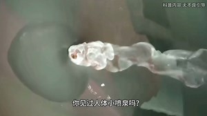 你知道斯基恩氏腺吗？这条正经科普视频一定要进来看一下。