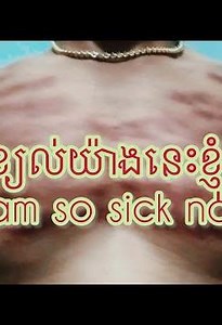 Coining is the best treatment in Asian people