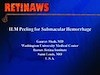 ILM Peeling for Submacular Hemorrhage - Eyetube