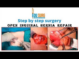Open Inguinal hernia surgery
