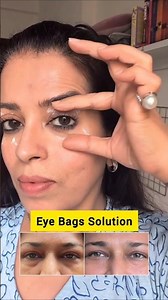 How to Reduce Eye Bags Naturally! 👁️✨ #FaceFitness #EyeCare
