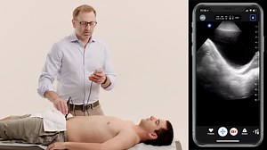 Ultrasound Training Videos For Education | Butterfly Network