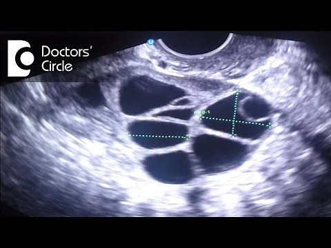 What do follicle size change in follicular study scan signify? - Dr. Teena S Thomas
