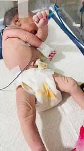 95K views · 5.1K reactions | The baby is having seizures!爐 Seizures in newborn babies are a serious medical emergency. The signs may not always be obvious like in adults. Watch for: • Sudden jerking of hands or legs • Eye rolling or staring • Body becoming stiff • Unusual breathing #fypシ゚viralシ #baby #sick #nicubaby #babycare #sweets | শিশুর যত্ন এবং স্বাস্থ্য পরামর্শ | Facebook