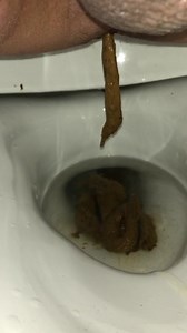 Endless diarrhea - video 2