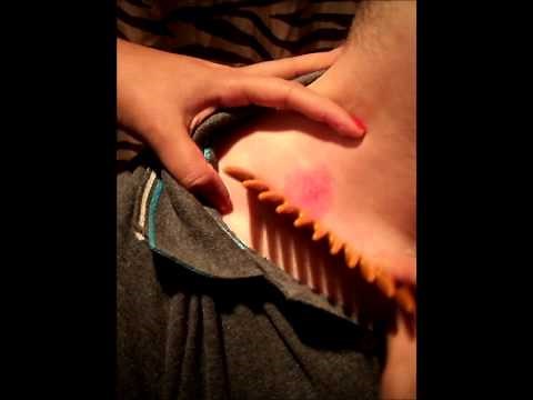 Como Quitar Un Chupeton