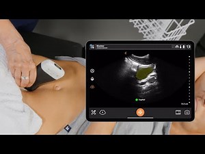Post Void Bladder Volume Measurement with Bladder AI