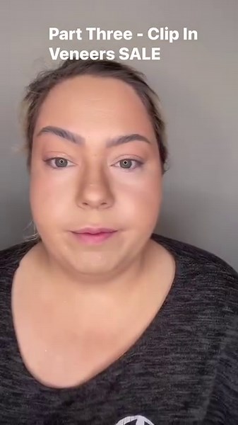71K views · 986 reactions | Part Three  #veneers #dentist #smile #dentistry #dental #cosmeticdentistry #smilemakeover #teeth #teethwhitening #smiledesign #veneergigi #hollywoodsmile #dentalimplants #dentalveneers #dentista #bleaching #orthodontics #veneerjakarta #dentalphotography #dentalcare #veneerbagus #tooth #invisalign #odontologia #veneer #dentalclinic #doktergigijakarta #porcelainveneers #whitesmile #cosmeticdentist | Lashes And Losing | Facebook