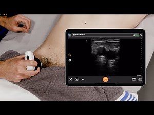 Femoral Vein for Central Line Placement