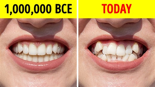 9.4K views · 32 reactions | Why Early Humans Had Perfectly Straight Teeth | Bright Planet | Facebook