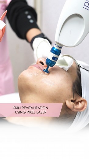 Pixel laser resurfacing is an effective treatment for scars and...