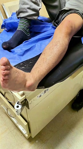 Cómo corregir una fractura-luxación de tobillo