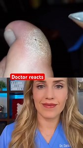 1.3M views · 2.8K reactions | Doctor reacts: foot callus art? | Footdocdana | Facebook
