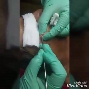 Faciales profundos para caballero incluye microdermambrasion para retirar piel muerta 95$ por cita solamente 3107412544 . . | Luxury El VIP SPA