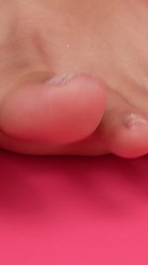 DIY Pedi Hacks To The Rescue 🥰 | Beauty Hacks