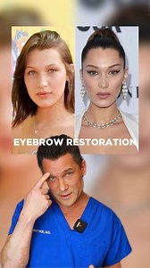 Motykie Med Spa on Instagram: "Eyebrow restoration has become increasingly popular as those who over-plucked their brows in the 80’s and 90’s hope to go from thin, low-arched eyebrows to bushier, sculpted eyebrows."
