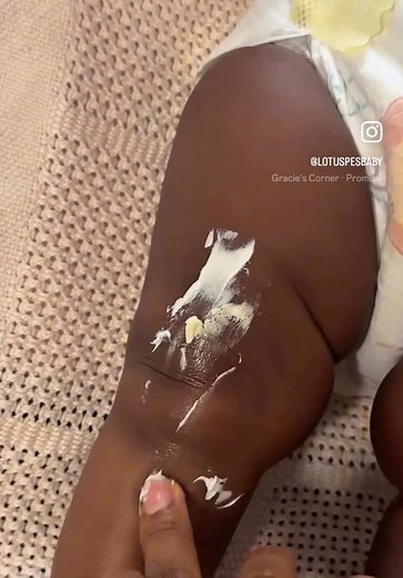 Gentle Skin Care Routine for Sensitive Children