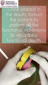 Manipulation of Greenstick Impression Compound