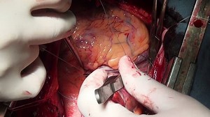 「Heart Beats Hands Professional Doctor During」の動画素材（ロイヤリティフリー）31719283 | Shutterstock