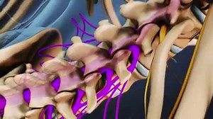 3K views · 172 reactions | Cauda equina syndrome can lead to urinary...