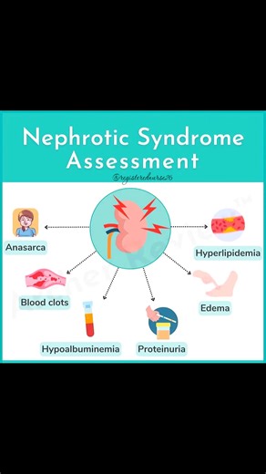 Nephrotic syndrome is a kidney disorder where there is increased permeability (large 🕳️ holes) in the glomeruli - this allows protein to leak from the blood ➡️ into the urine! With this condition, we expect to see symptoms such as excess ⬆️ protein in the urine (& low ⬇️ levels in the blood), edema, hyperlipidemia, and even blood clots. Nephrotic syndrome is usually seen in the pediatric 👶 population, but can also affect adults! #fypシ #nurselife #registerednurse #nepalinurses #nclexmaterials #