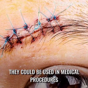 Scientists have developed an artificial, eco-friendly spider silk. | Green Matters