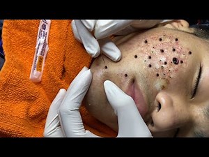 Enjoy Every Day With The Best Video Loan Nguyen Spa Official | 908