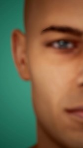 2.2K views | Auricular hematoma, more commonly known as cauliflower...