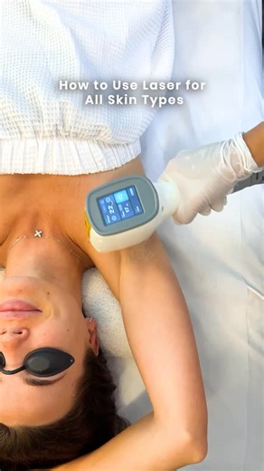 💡How to Use Diode Laser for All Fitzpatrick Skin Types (I–VI) Understanding wavelength = understanding safety results. ✨ Diode lasers with 755nm, 808nm, and 1064nm combined wavelengths allow for customized energy delivery—targeting melanin at different skin depths. 🔬 Here’s the science: 📍 755nm – Ideal for Fitz I–III: Targets melanin at shallow levels. Fast results for lighter skin, but higher risk of PIH in darker tones. 📍 808nm – The universal standard: Moderate depth balanced absorption =