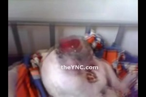 Anencephaly Vol 1