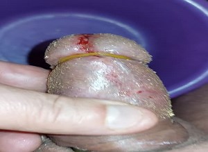 Pain cbt insertion bdsm extrem pervers maggots eating cock