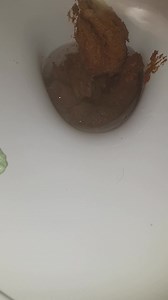Urgent poop - video 10