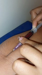 Nurse duty ❤️ #instagram #nurse #viral #facebook | Moumi Dutta | Facebook