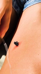 360K views · 1.4K reactions | Trucchi di Primo Soccorso Che Devi Imparare! | 5 Minuti Creativi | Facebook