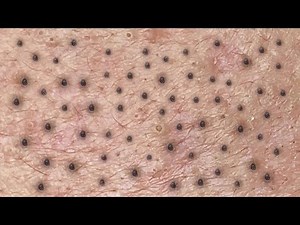 Satisfying Relaxing with Sac Dep Spa Video (#184)