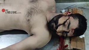 Medical! Man Autopsy